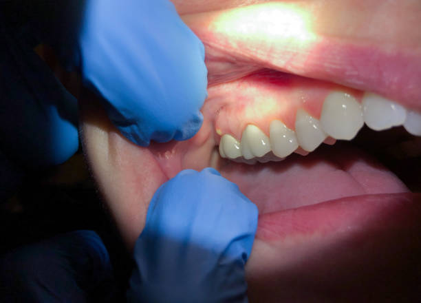 Best Orthodontic Emergency Dentist in Vine Hill, CA