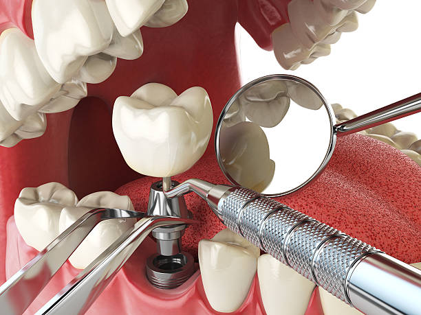 Best Pediatric Emergency Dentist in Vine Hill, CA
